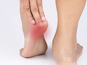 Plantar Fasciitis